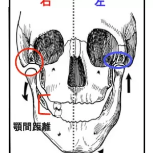 体が歪むと顔にも影響が・・・のサムネイル